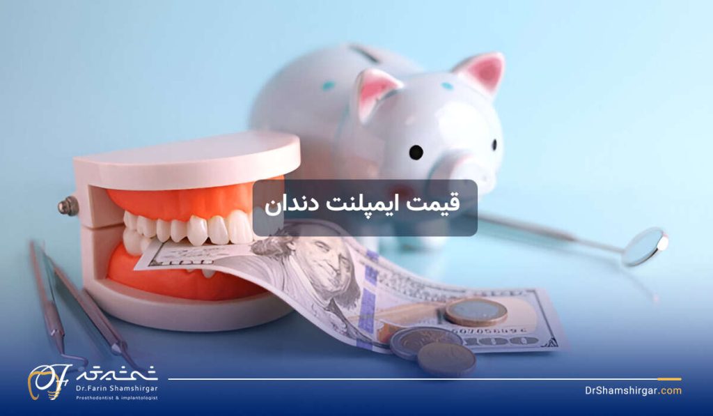 هزینه ایمپلنت دندان
