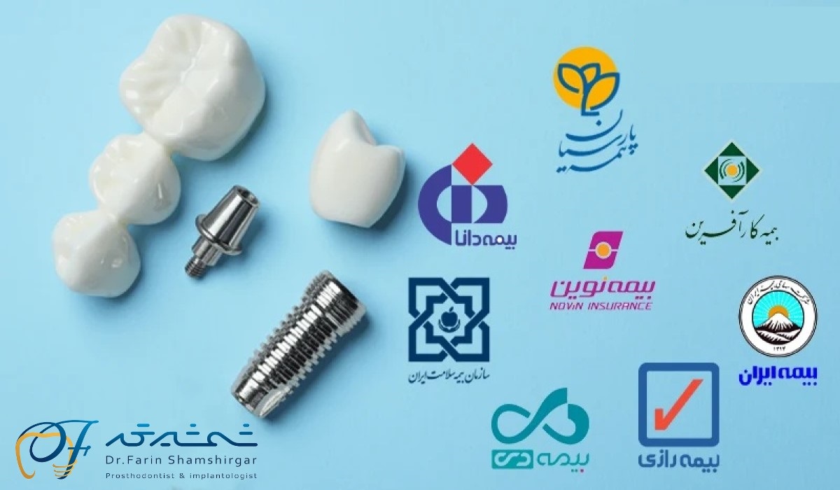 هزینه ایمپلنت دندان