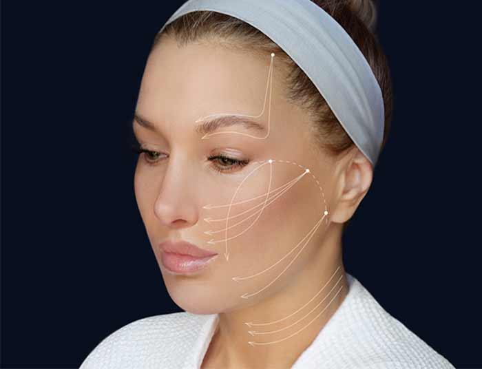 محل های لیفت با نخ