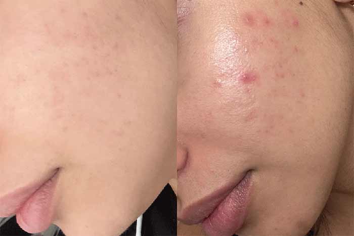 قبل و بعد از مصرف