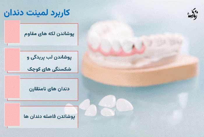 انواع کاربرد لمنیت دندان