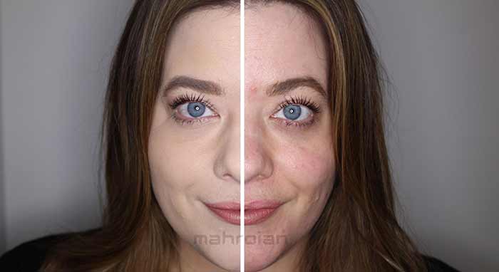 زیبایی پوست