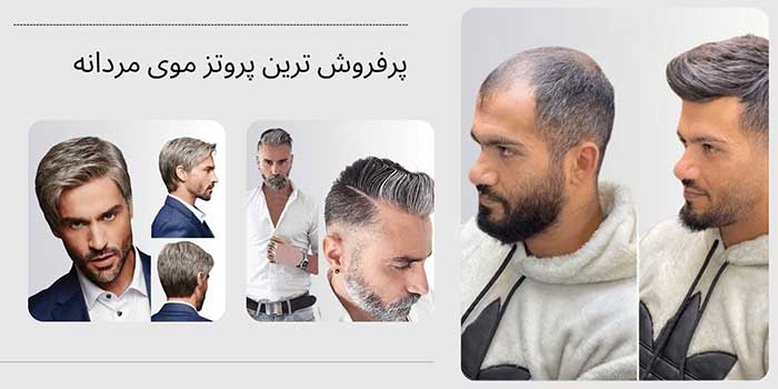 پروتزهای موی مردانه پرفروش