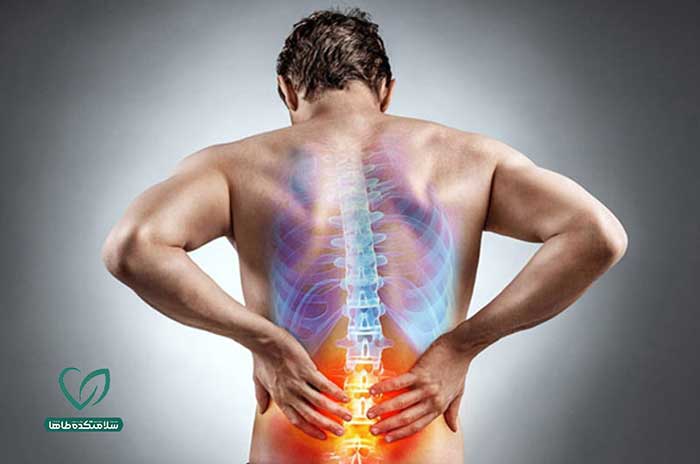 معرفی راه‌های آرام کردن درد دیسک کمر