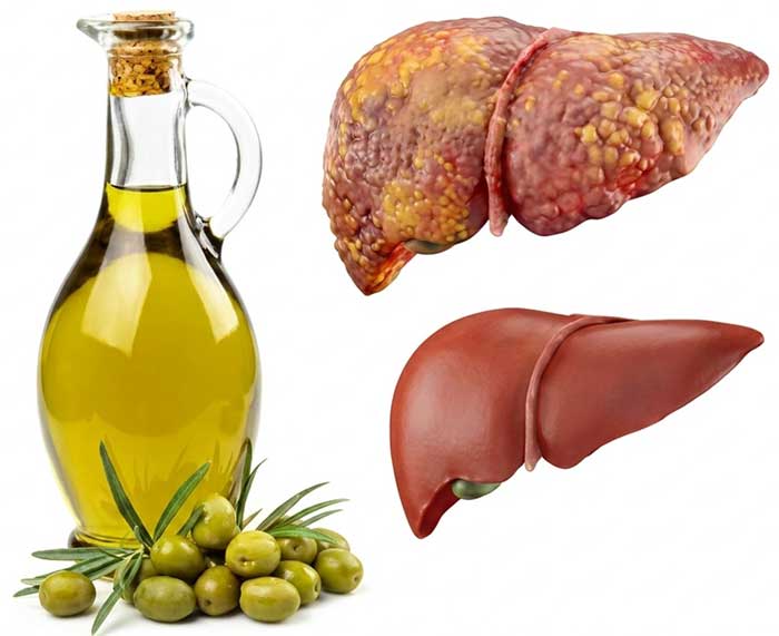 کبد چرب بهترین روغن زیتون برای کبد چرب